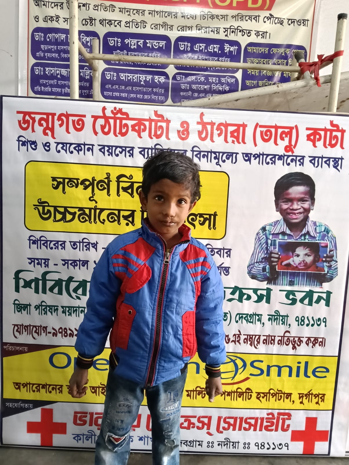 Operation Smile
